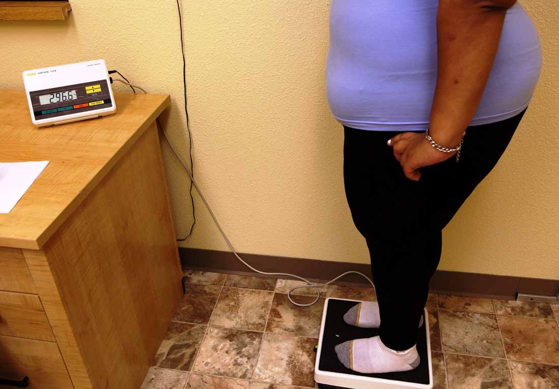 Obesity’s Health Hazards: Unraveling Complications