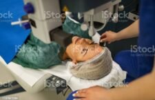 Preparing patient for laser eye surgery