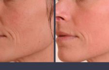 abilene-plastic-surgery-meds-pa-reconstructive